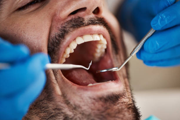Best Cracked Tooth Emergency Dentist  in Noble, OK