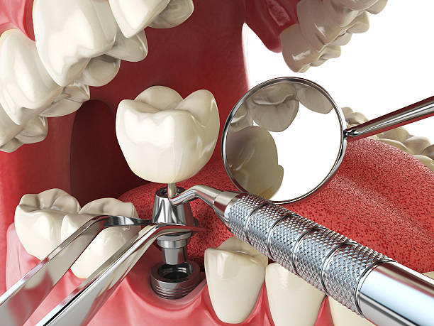 Best Urgent Tooth Repair  in Noble, OK